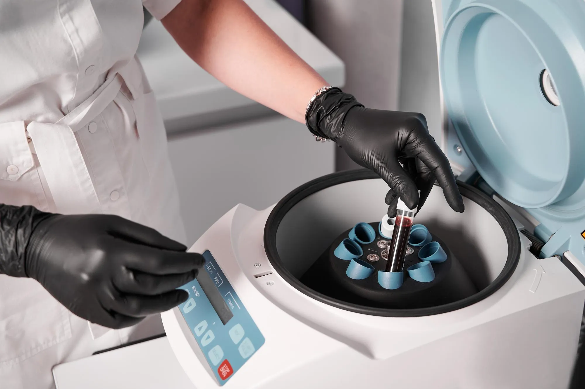 Ovarian Cryopreservation Process